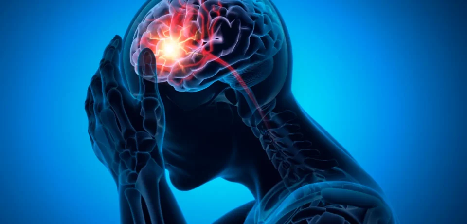 Man with a strong headache -  Brain Stroke - Medical X Ray 3D Illustration with blue background