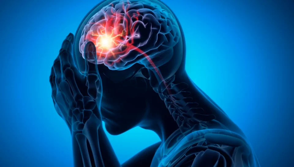 Man with a strong headache -  Brain Stroke - Medical X Ray 3D Illustration with blue background